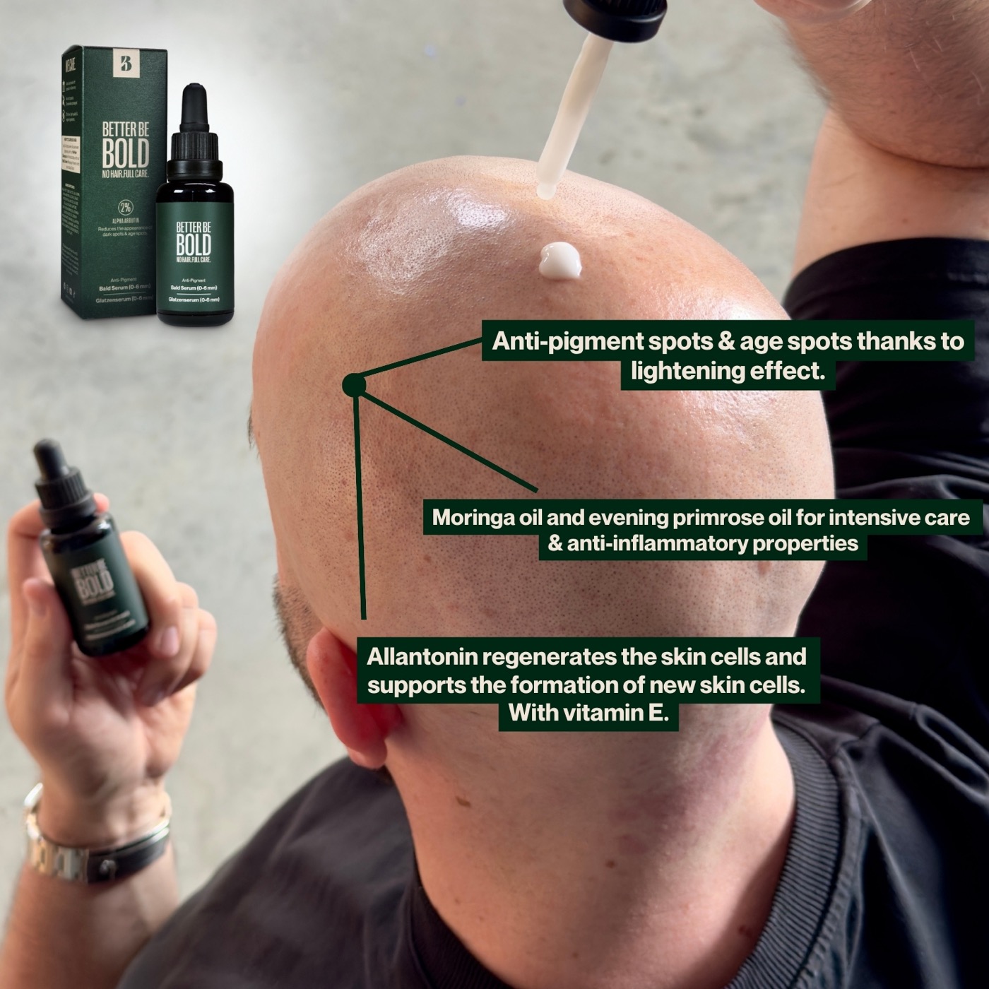 Anti-Pigment Bald Serum