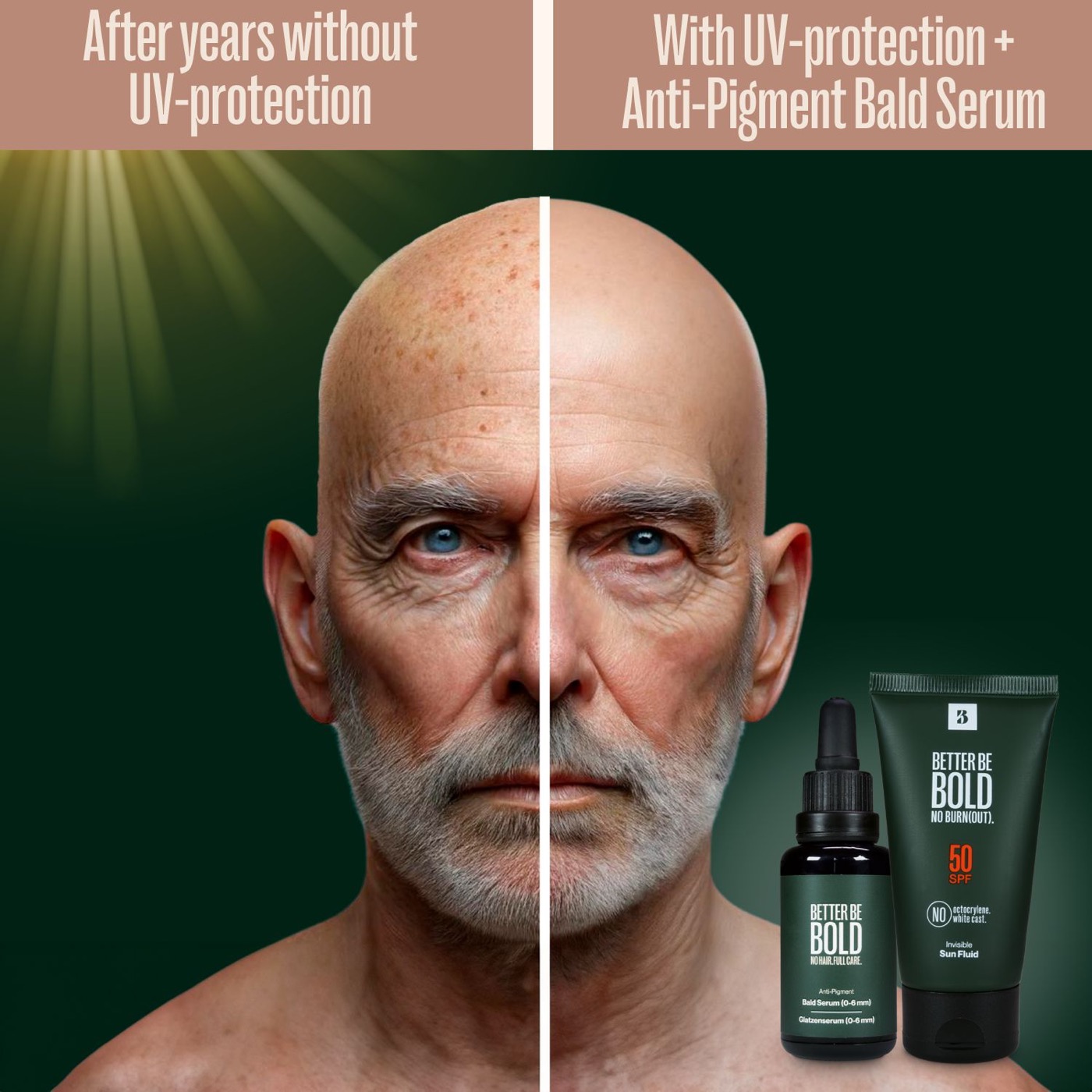 Anti-Pigment Bald Serum